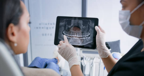 Licensed Tooth Extraction service in Westwood, CA - Smile Center Dentistry